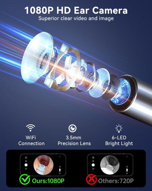 Ear Cleaner Tool With Camera - Image 10