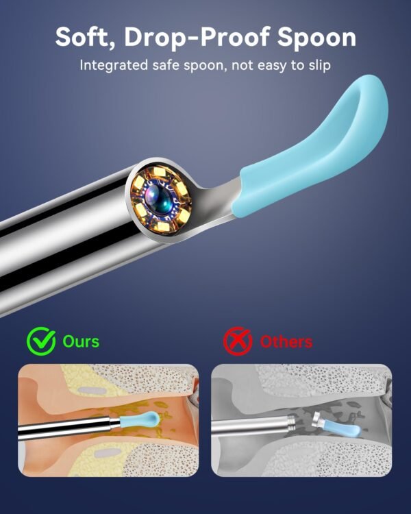 Ear Cleaner Tool With Camera - Image 9