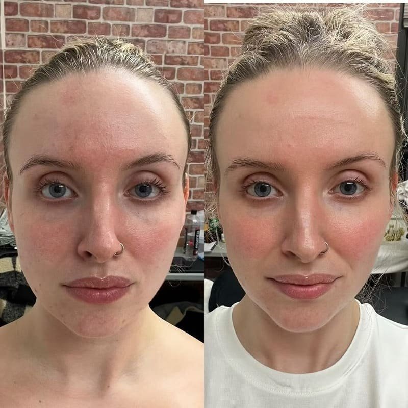 Handheld Lymphatic Brush for Facial Massage - Image 5