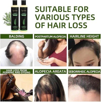 Tgideas Rosemary Shampoo - Image 3